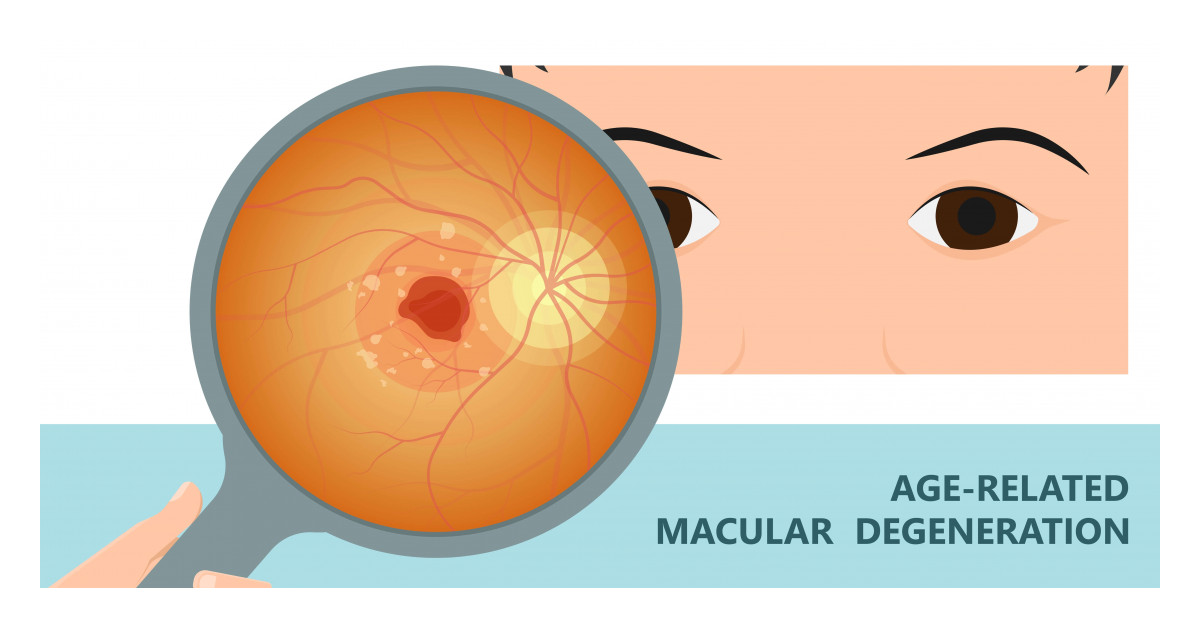 Mid Atlantic Retina Physicians Part Of Clinical Trial Team For