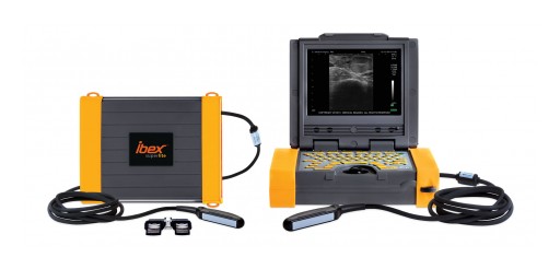 E.I. Medical Imaging Announces the Release of Ibex® Pro-R and SuperLite Ultrasound Systems