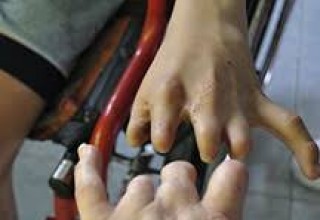 Hands of Agent Orange