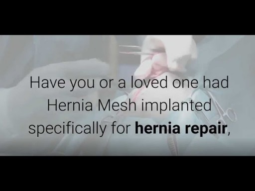 Hernia Mesh Lawsuit Claim-Call 866-382-5297