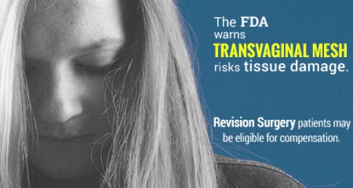 Latest News on Transvaginal Mesh Lawsuits