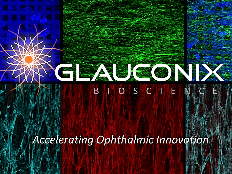 Glauconix Biosciences Inc., Thursday, March 14, 2019, Press release picture