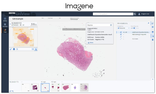 Imagene Increases Accessibility of Rapid AI-Based Biomarker Profiling Through Integration With Sectra