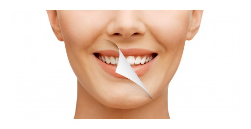 The Sacramento Dentistry Group Answers: Do Home Tooth Whiteners Work?