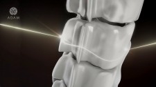 Inorganic, bioabsorbable bone transplants