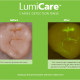 GreenMark Secures FDA Clearance for LumiCare™ Caries Detection Rinse