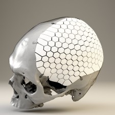 OSSDSIGN® Cranial