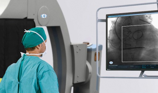 Omega Medical Imaging First in the World to Receive FDA Clearance on Artificial Intelligence Imaging System That Reduces Dose