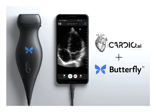 iCardio.ai Joins Butterfly Garden to Deploy Its Cardiac AI Suite on Butterfly Network’s Imaging Platform
