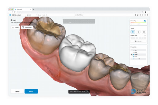 Imagoworks Launches AI-Based Web Dental CAD 3Dme Crown