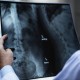 Rockpoint Legal Funding: Spine Injury Surgeries - Time is of the Essence