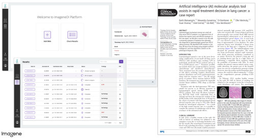 Imagene Launches ImageneOI Platform on Oracle Cloud Infrastructure to Democratize AI-Based Molecular Profiling in Oncology