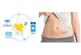 AID system based on DBLG1 and MEDISAFE WITH, Patient wearing MEDISAFE WITH