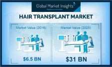 Hair Transplant Industry 2025 