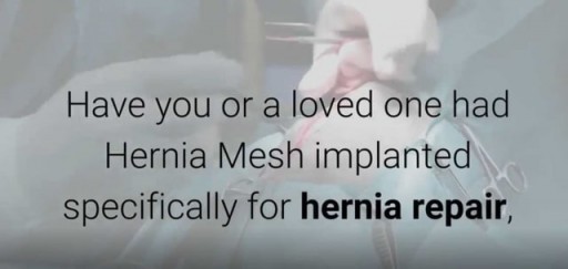 Hernia Mesh Lawsuit Claim-Call 866-382-5297