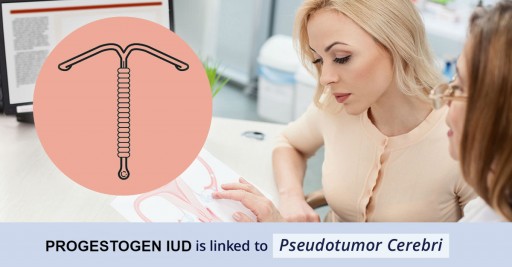 Intrauterine Devices (IUD) With Progestogen Linked to Pseudotumor Cerebri, Warns Consumer Safety Watch