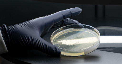 Microbiologics Acquires Cryologics