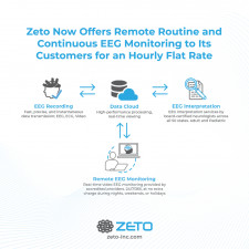 Zeto Offers Remote EEG Monitoring Service