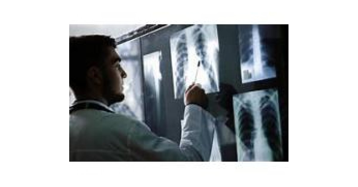 Diagnostic XRay Imaging Market Demand by 2025 QY Research Newswire