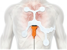 EKG Patch Solution