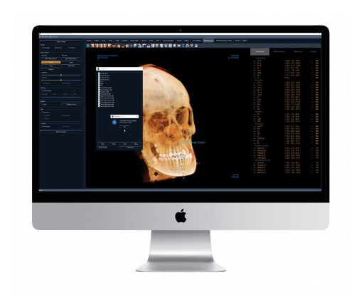Osteoid Inc. Launches Revolutionary AI-Driven Automatic 3D Cephalometric Tracing in the Latest Version of Invivo