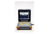 Ibex® EVO® Portable Ultrasound