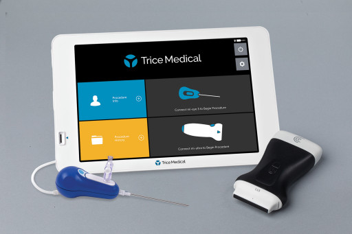 Clarius Inks Deal to Integrate High-Definition Ultrasound With Trice Medical's Portable Orthopedic Diagnosis and Arthroscopy Treatment Platform