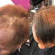 Repair Edges and Accelerate Hair Growth From the Inside Out