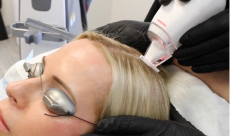 Needle-Free Platelet-Rich Plasma Grows Hair Through Thulium Laser Technology
