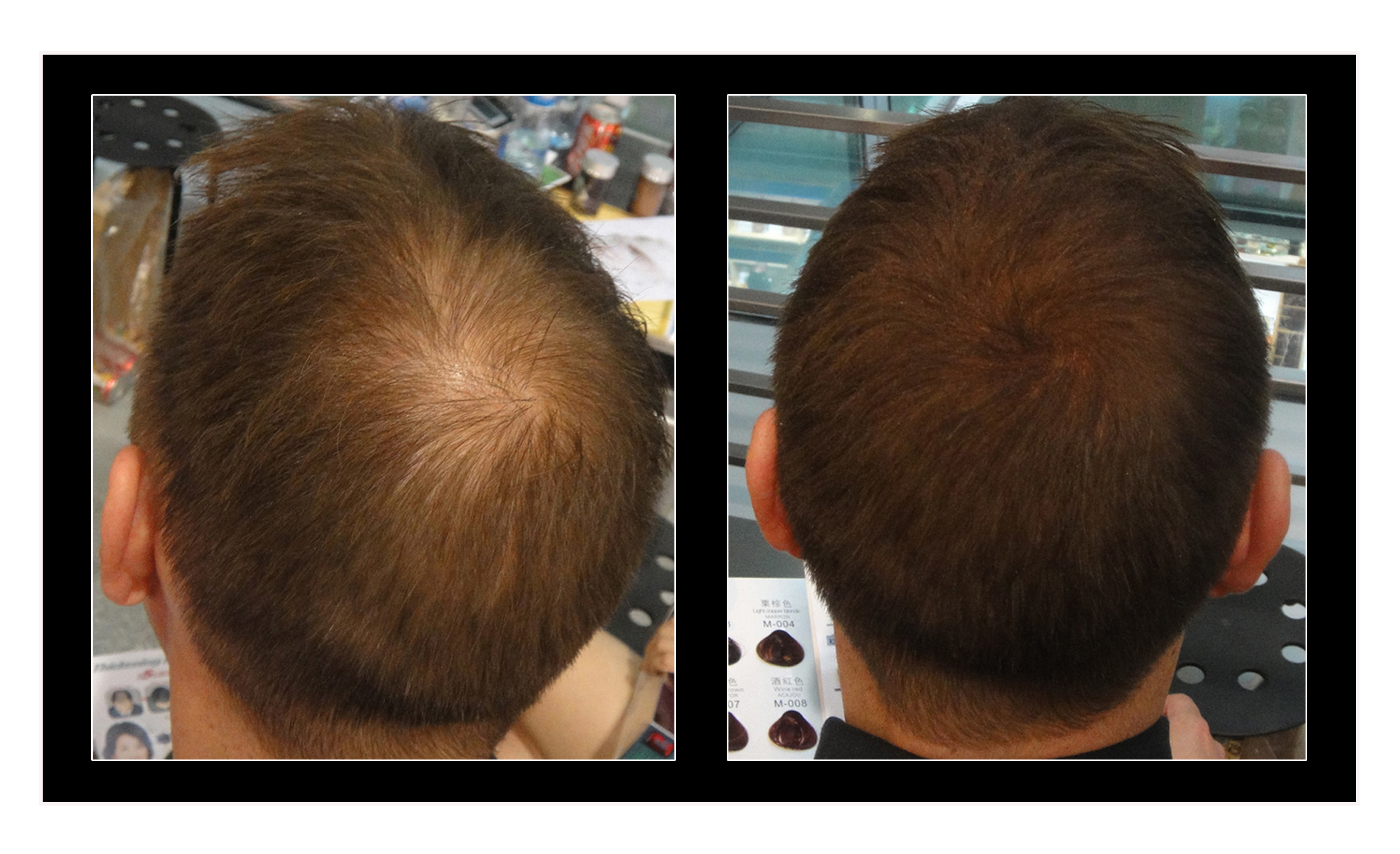 Allure Hair Building Fibers Launches New AllNatural Hypoallergenic