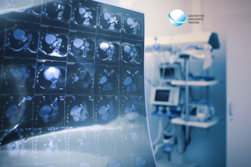 The Center for Diagnostic Imaging Explains the Importance of CT Scans for Diagnostic Imaging