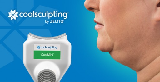 Introducing the CoolMini Applicator for Coolsculpting Treatment to Trifecta Med Spa in New York