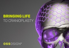 Bringing Life to Cranioplasty