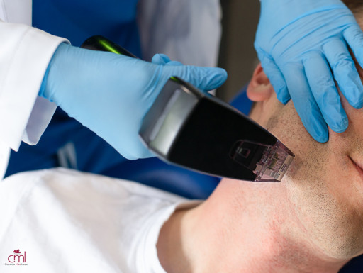 Morpheus8 at Canada MedLaser Clinics: Redefining Beauty With Advanced Skin Rejuvenation and Contouring