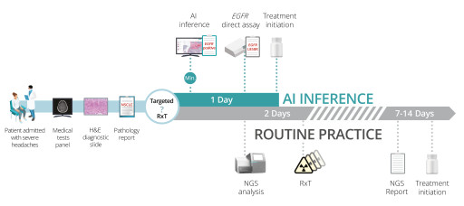 Los perfiles moleculares basados en inteligencia artificial de Imagene revolucionan el diagnóstico del cáncer de pulmón: Dos pacientes reciben terapia dirigida inmediata y evitan la radiación cerebral