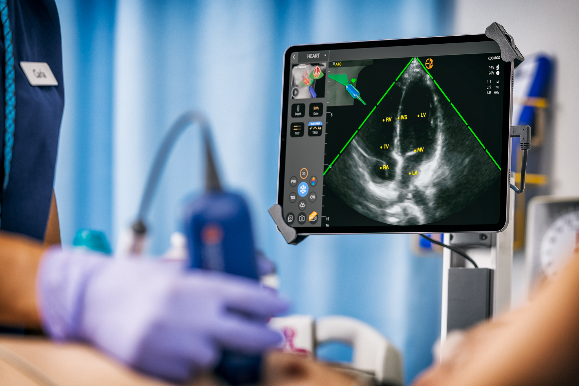 Point of Care Ultrasound Technology (POCUS) With AI