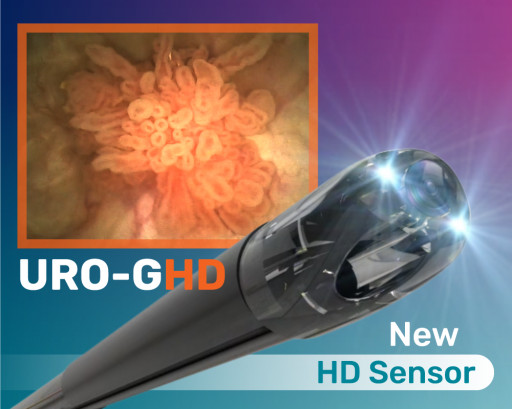 UroViu Launches Uro-GHD, a New High-Definition Sterile Single-Use Cystoscope