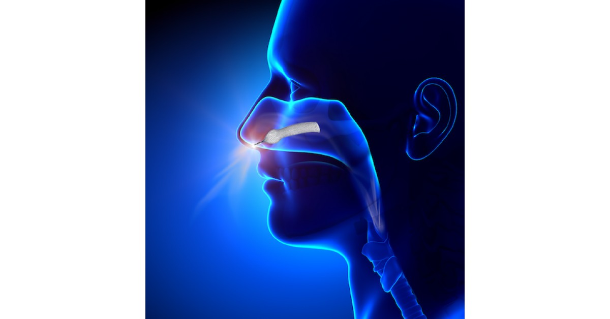 Alaxo Airway Stents (Alaxo) Announces That Brian Benning, Former