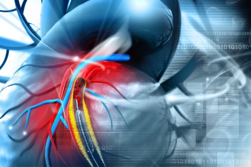 Ampronix Medical Imaging Manufacturer Reviews New Medical Guidelines for Open Heart Surgery Within the Medical Industry and Describes How to Preserve a Prosthetic Heart