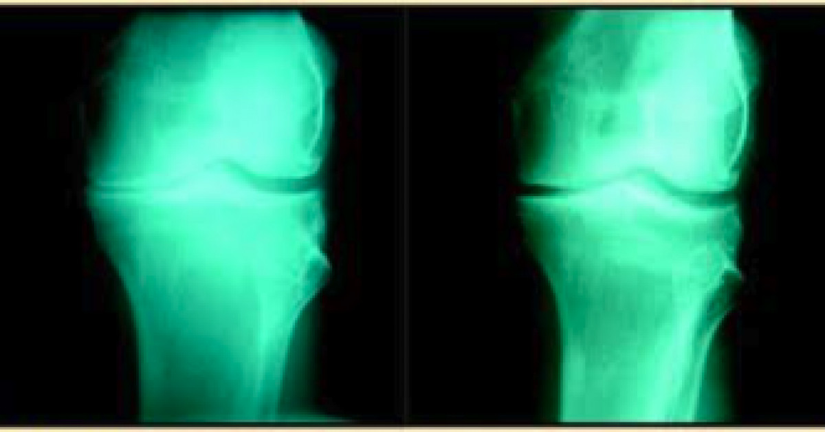 The Center for Regenerative Medicine Offers StateoftheArt Non