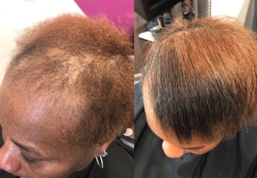 Repair Edges and Accelerate Hair Growth From the Inside Out