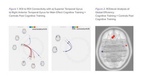 LearningRx Reviews Research Study That Showed Brain Training Created New Brain Connections