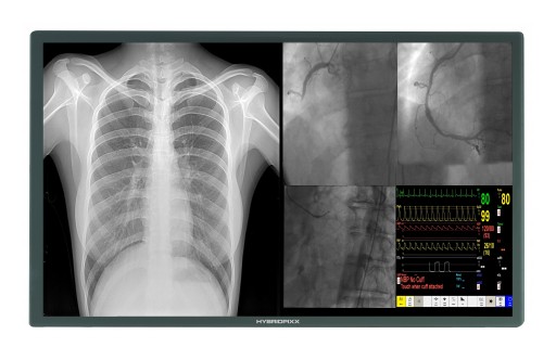 HD 4K 8MP Cath Lab Display Monitor LCD/LED Screens See Superior Advancement in Medical Technology - Ampronix