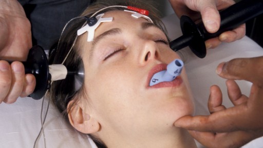 CCHR Calls for a Ban on Electroshock