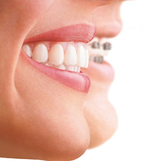 First Dedicated Center for Invisalign® Treatments Opens in Dubai