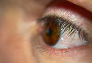 Close up: Steve Verze - fully digital 3D printed prosthetic eye
