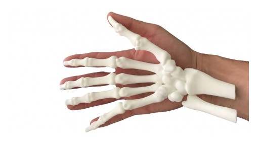 Stoke Med to Provide Patient Specific 3D-Printed Models