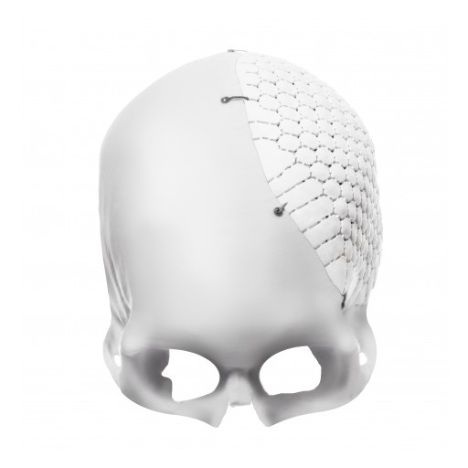 OSSDSIGN Cranial