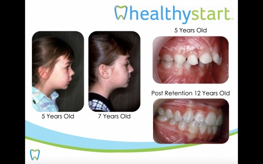 February is Children's Dental Health Month: The Real News-Flash Our Children Are GROWING INTO PROBLEMS