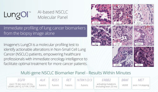 Imagene Announces LungOI, the First AI-Based NSCLC Molecular Panel for Immediate Cancer Biomarker Profiling